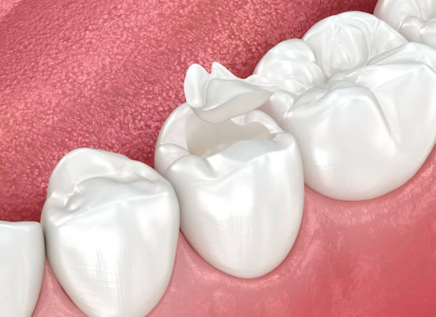 Best Cosmetic Dentistry  in Lauderdale Lakes, WI